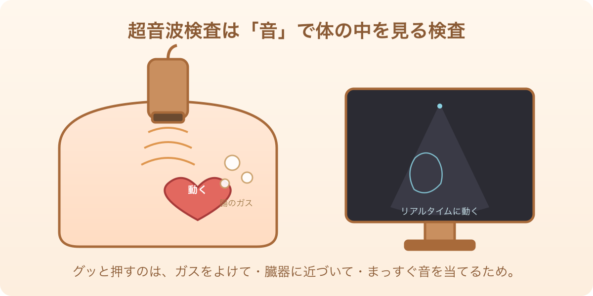 プローブから音の波が体内へ届き、モニターにリアルタイムで臓器が映るエコー検査のしくみのイラスト
